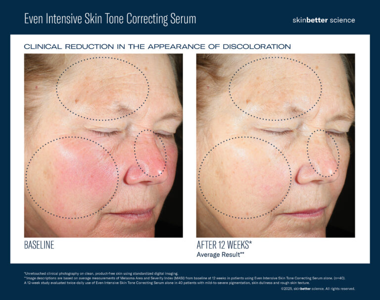 Even Intensive Skin Tone Correcting Serum Before&After JPEG Template